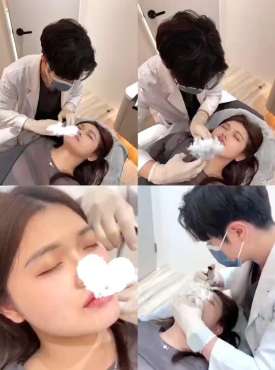 嘴唇玻尿酸會痛嗎？這次讓我徹底改觀！